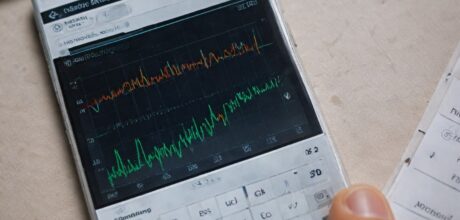 O que é renda fixa e como investir com segurança